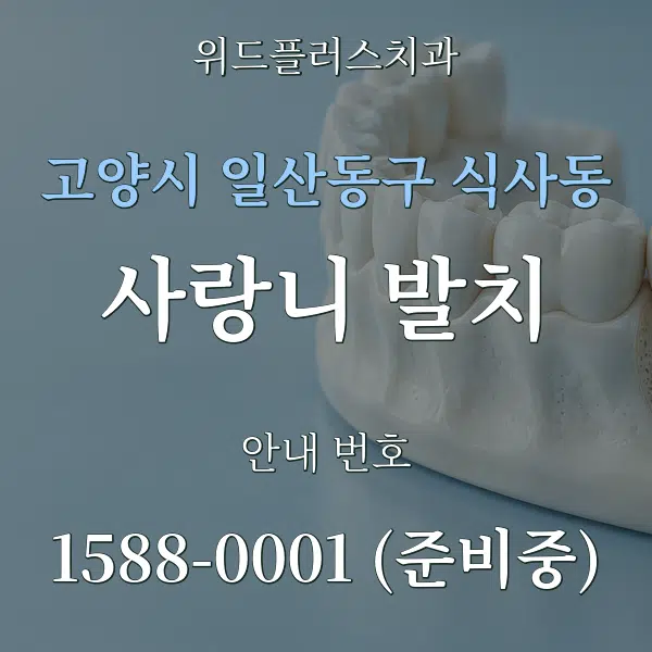 고양시 일산동구 식사동 사랑니 발치 대표 안내 그래픽