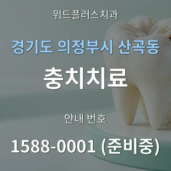경기도 의정부시 산곡동 충치치료 대표 안내 그래픽