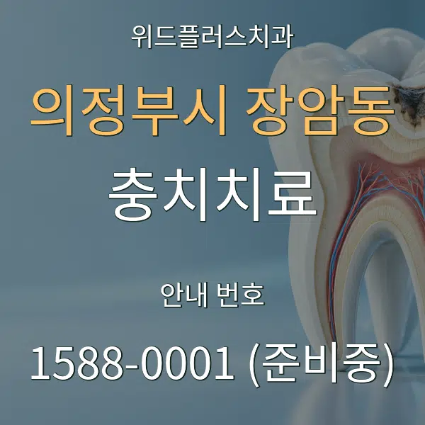 의정부시 장암동 충치치료 대표 안내 그래픽
