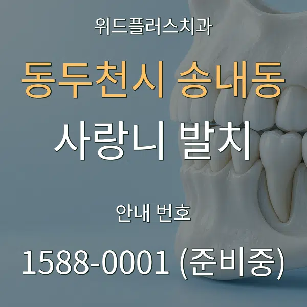 동두천시 송내동 사랑니 발치 대표 안내 그래픽