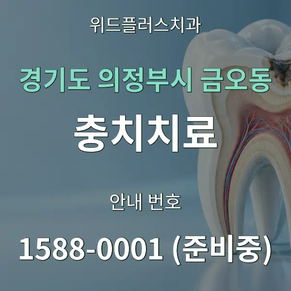 경기도 의정부시 금오동 충치치료 대표 안내 그래픽