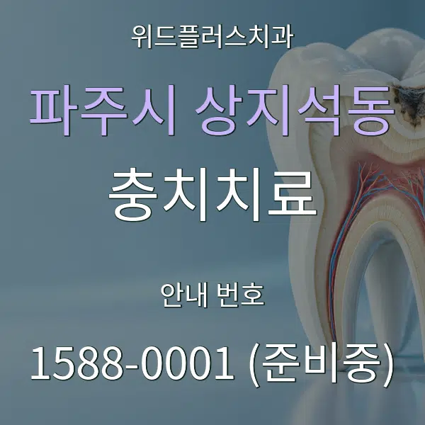 파주시 상지석동 충치치료 대표 안내 그래픽