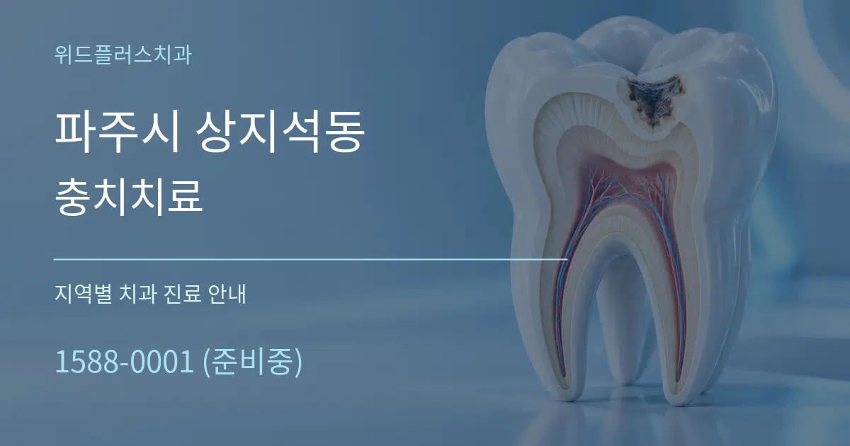 파주시 상지석동 충치치료 대표 안내 그래픽