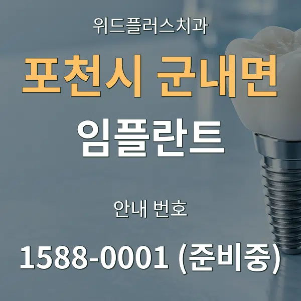 포천시 군내면 임플란트 대표 안내 그래픽