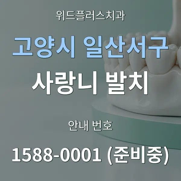 고양시 일산서구 사랑니 발치 대표 안내 그래픽