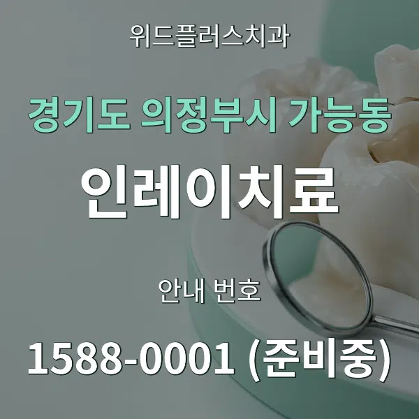 경기도 의정부시 가능동 인레이치료 대표 안내 그래픽