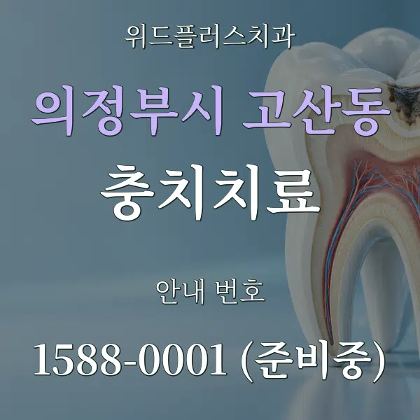 의정부시 고산동 충치치료 대표 안내 그래픽