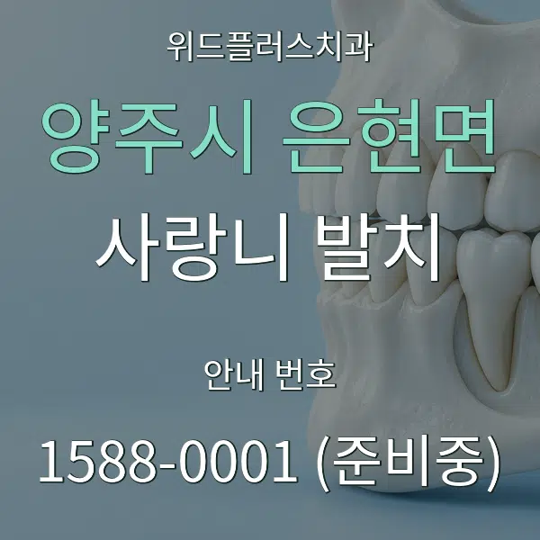 양주시 은현면 사랑니 발치 대표 안내 그래픽