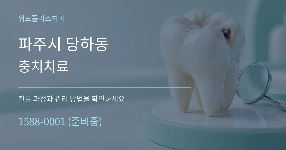 파주시 당하동 충치치료 작업 조건 안내 그래픽
