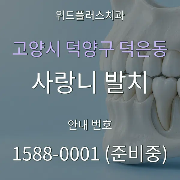 고양시 덕양구 덕은동 사랑니 발치 대표 안내 그래픽