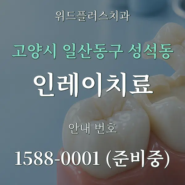 고양시 일산동구 성석동 인레이치료 대표 안내 그래픽
