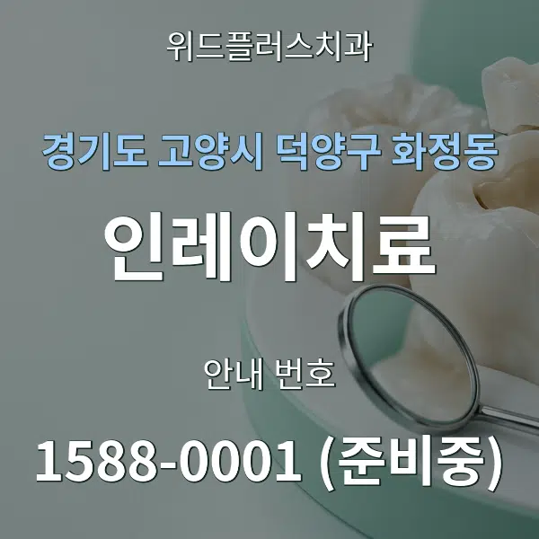 경기도 고양시 덕양구 화정동 인레이치료 대표 안내 그래픽