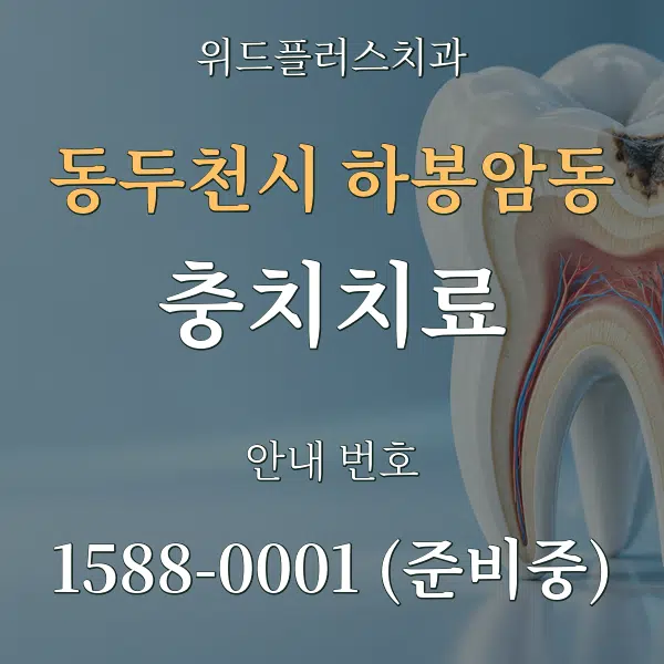 동두천시 하봉암동 충치치료 대표 안내 그래픽
