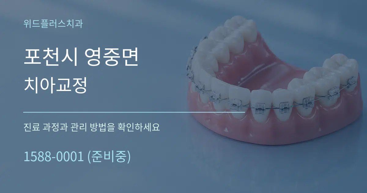 포천시 영중면 치아교정 작업 조건 안내 그래픽