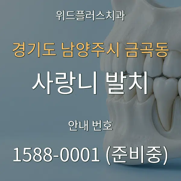 경기도 남양주시 금곡동 사랑니 발치 대표 안내 그래픽