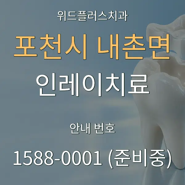 포천시 내촌면 인레이치료 대표 안내 그래픽