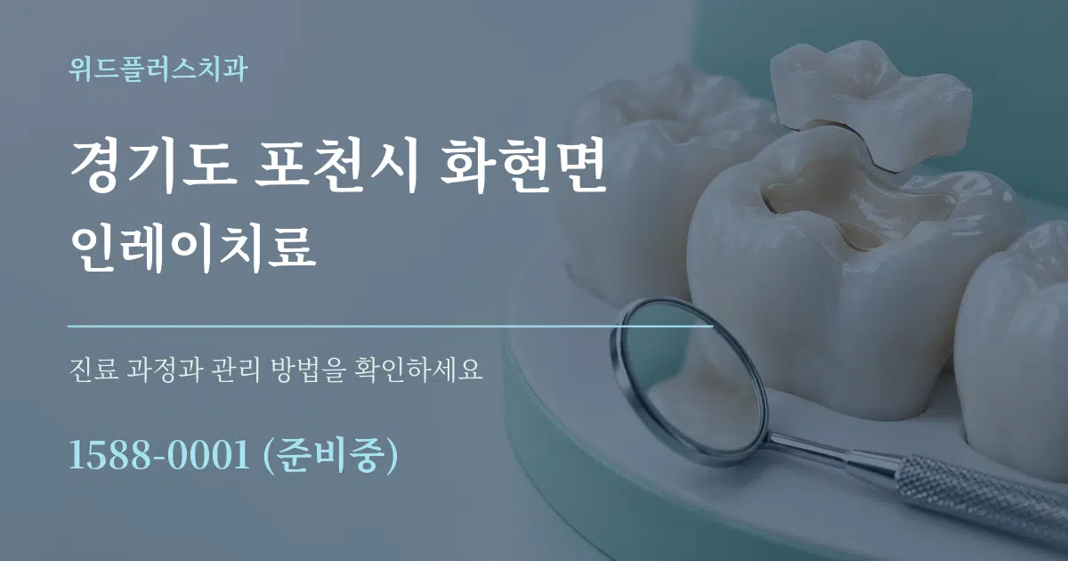 경기도 포천시 화현면 인레이치료 작업 조건 안내 그래픽