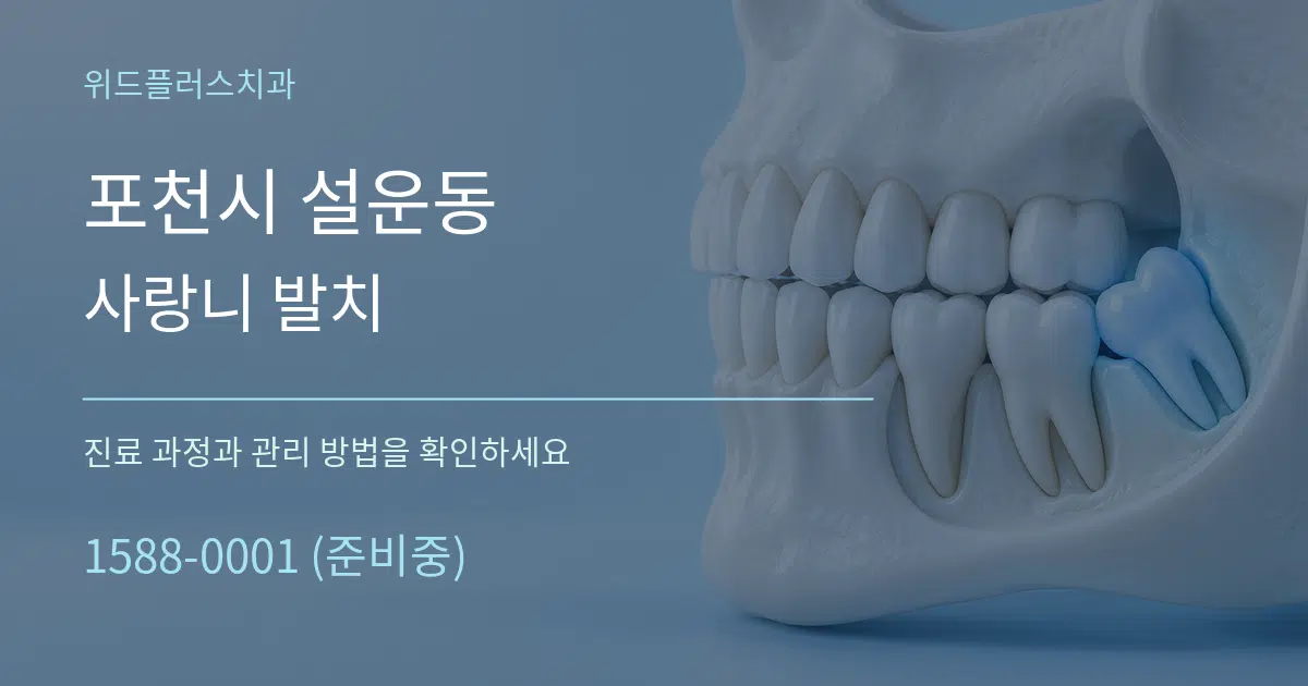 포천시 설운동 사랑니 발치 작업 조건 안내 그래픽