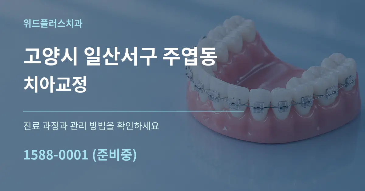 고양시 일산서구 주엽동 치아교정 작업 조건 안내 그래픽