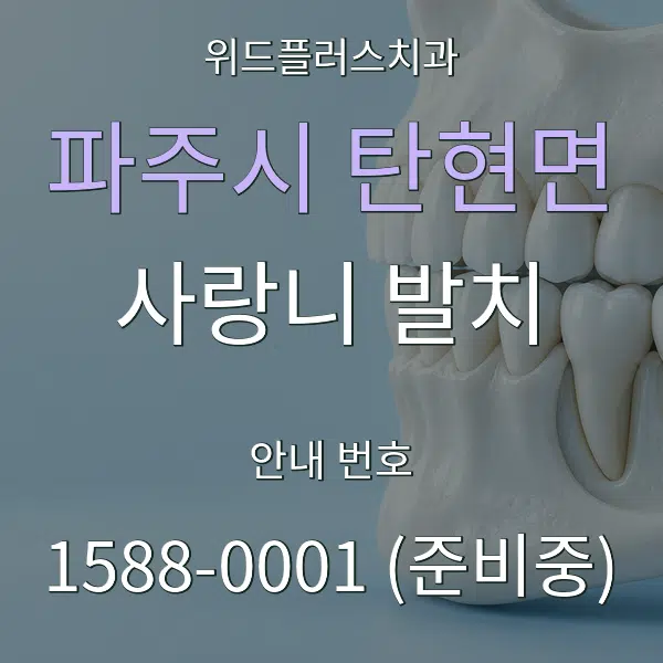 파주시 탄현면 사랑니 발치 대표 안내 그래픽