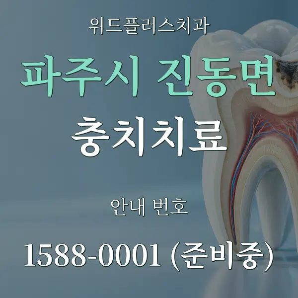 파주시 진동면 충치치료 대표 안내 그래픽
