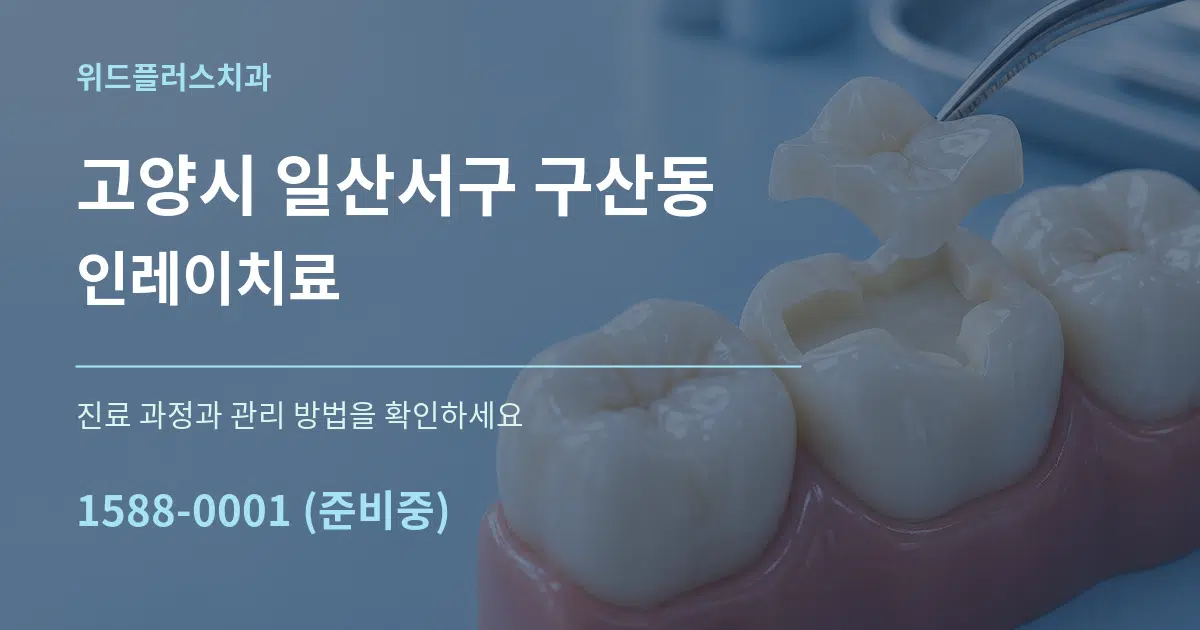 고양시 일산서구 구산동 인레이치료 서비스 이용 안내 그래픽