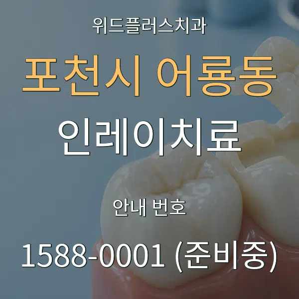 포천시 어룡동 인레이치료 대표 안내 그래픽