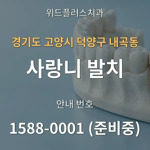 경기도 고양시 덕양구 내곡동 사랑니 발치 대표 안내 그래픽