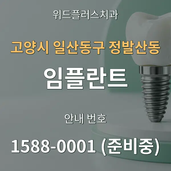 고양시 일산동구 정발산동 임플란트 대표 안내 그래픽