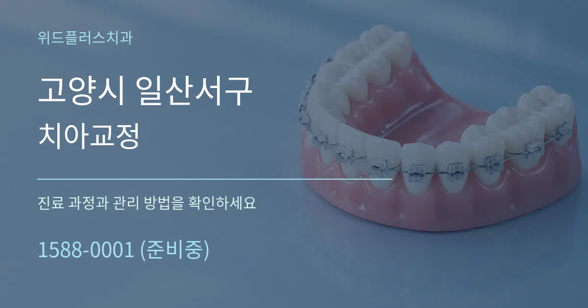 고양시 일산서구 치아교정 작업 조건 안내 그래픽