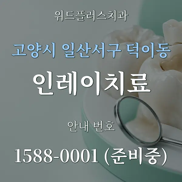 고양시 일산서구 덕이동 인레이치료 대표 안내 그래픽