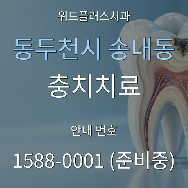 동두천시 송내동 충치치료 대표 안내 그래픽