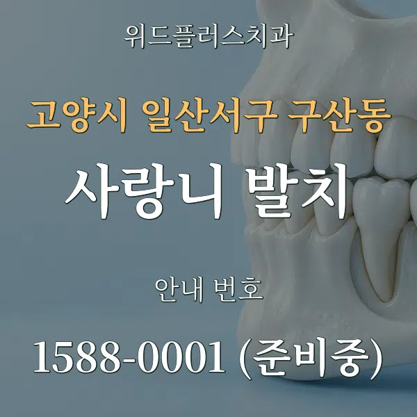 고양시 일산서구 구산동 사랑니 발치 대표 안내 그래픽