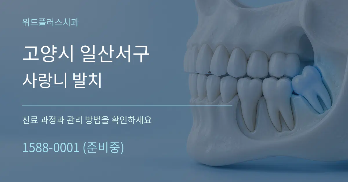 고양시 일산서구 사랑니 발치 서비스 이용 안내 그래픽