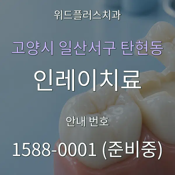 고양시 일산서구 탄현동 인레이치료 대표 안내 그래픽