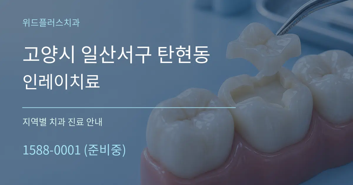 고양시 일산서구 탄현동 인레이치료 대표 안내 그래픽
