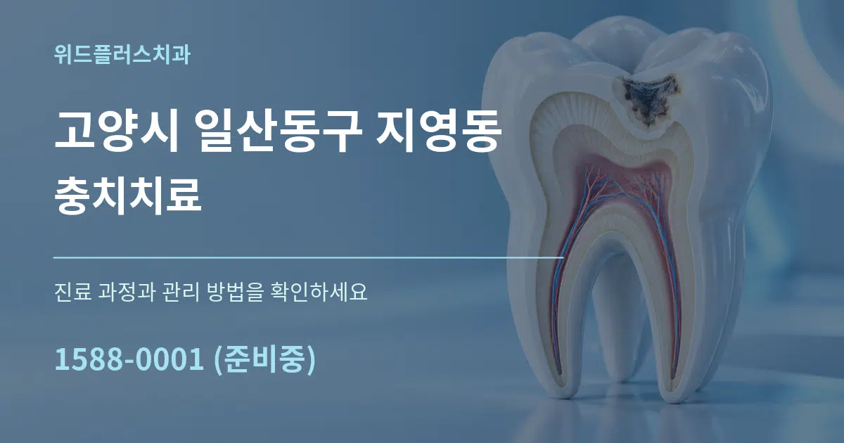 고양시 일산동구 지영동 충치치료 작업 조건 안내 그래픽