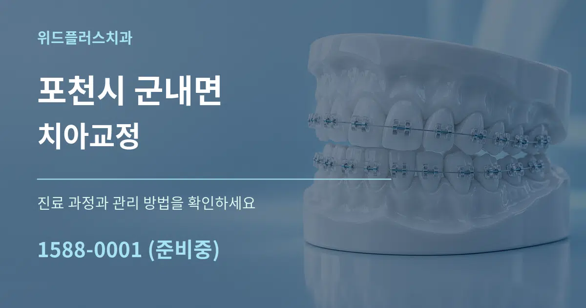 포천시 군내면 치아교정 작업 조건 안내 그래픽
