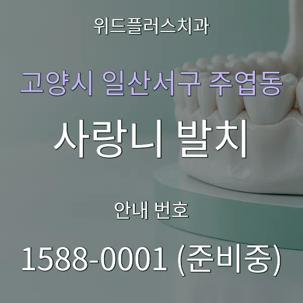 고양시 일산서구 주엽동 사랑니 발치 대표 안내 그래픽