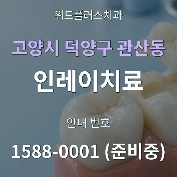 고양시 덕양구 관산동 인레이치료 대표 안내 그래픽