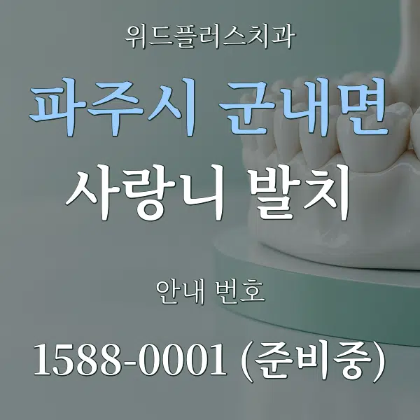 파주시 군내면 사랑니 발치 대표 안내 그래픽