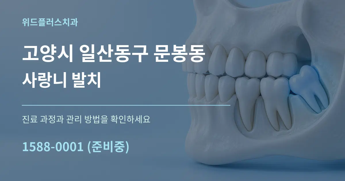 고양시 일산동구 문봉동 사랑니 발치 서비스 이용 안내 그래픽