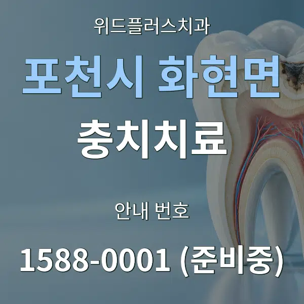 포천시 화현면 충치치료 대표 안내 그래픽