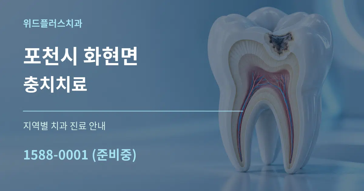 포천시 화현면 충치치료 대표 안내 그래픽