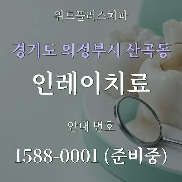 경기도 의정부시 산곡동 인레이치료 대표 안내 그래픽