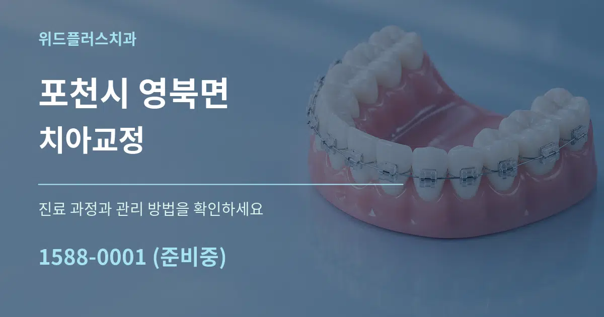포천시 영북면 치아교정 작업 조건 안내 그래픽