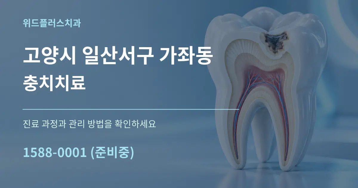 고양시 일산서구 가좌동 충치치료 작업 조건 안내 그래픽