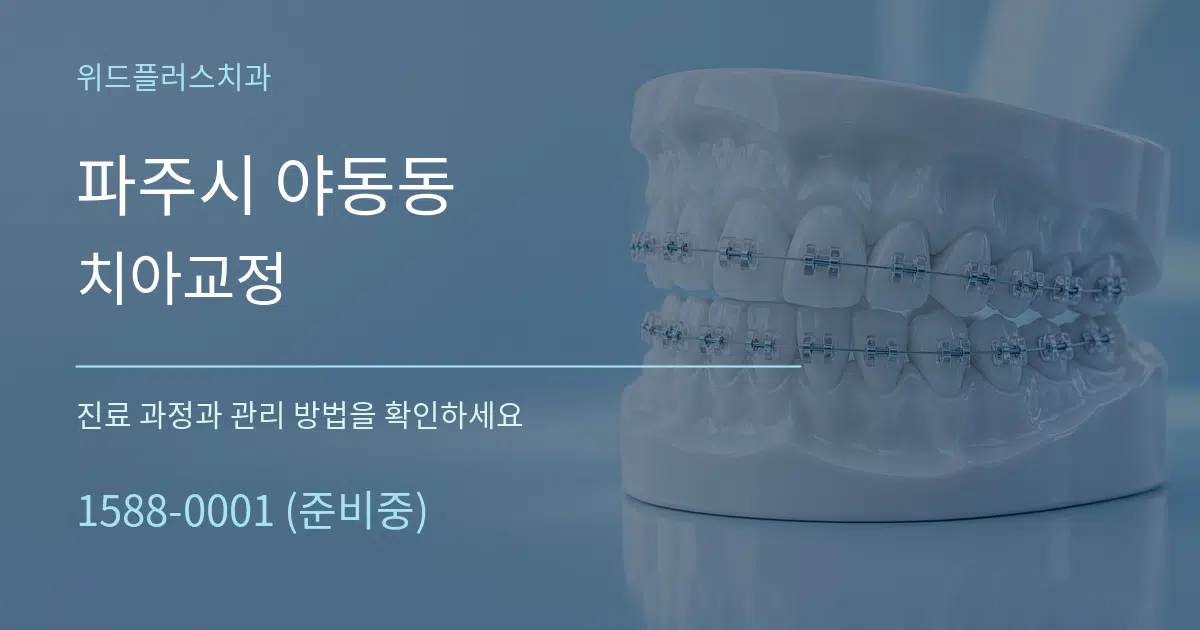 파주시 야동동 치아교정 작업 조건 안내 그래픽