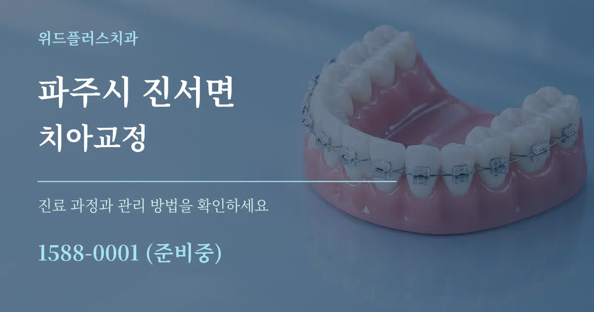 파주시 진서면 치아교정 작업 조건 안내 그래픽