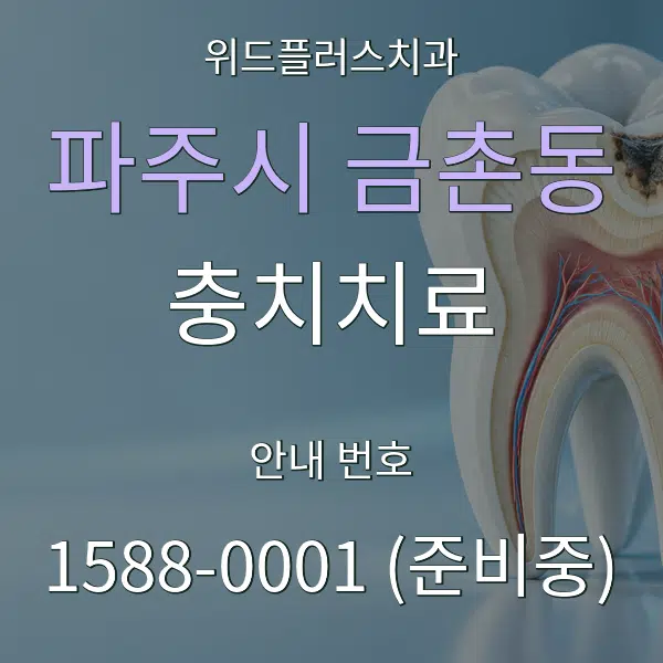 파주시 금촌동 충치치료 대표 안내 그래픽